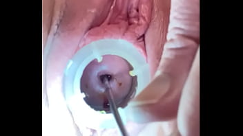 Xhamatwrlive cervix penetration